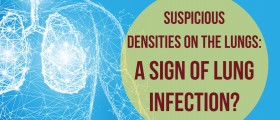 Suspicious Densities On The Lungs: A Sign Of Lung Infection?
