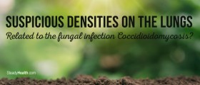 Suspicious Densities On The Lungs: Related To The Fungal Infection Coccidioidomycosis?