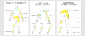 Symptoms And Treatment: The Difference Between Fibromyalgia And Myofascial Pain Syndrome