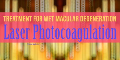 Treatment for Wet Macular Degeneration: Is Laser Photocoagulation The Treatment of Your Choice?
