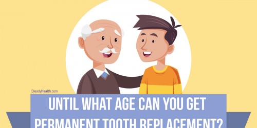 Until What Age Can You Get Permanent Tooth Replacement?