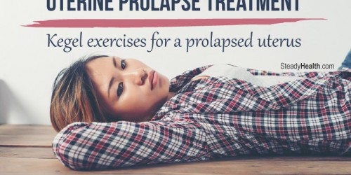 Uterine Prolapse Treatment: Kegel Exercises and Pelvic Floor Muscle Training for a Prolapsed Uterus