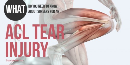 What Do You Need To Know About Surgery For An ACL Tear Injury?
