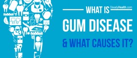 What Is Gum Disease And What Causes It?