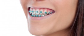 What Should Folks With Misaligned Or Crowded Teeth, Braces Or Dental Bridges Know About Gum Disease?