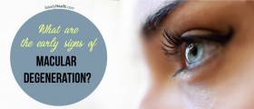 What are the Early Signs of Macular Degeneration?