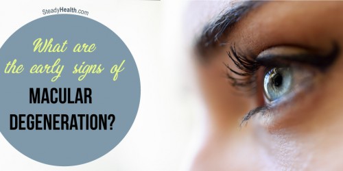 What are the Early Signs of Macular Degeneration?