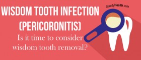 Wisdom Tooth Infection (Pericoronitis): Is It Time To Consider Wisdom Tooth Removal?