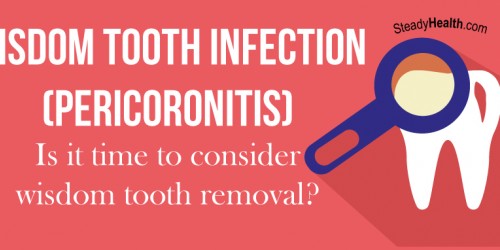 Wisdom Tooth Infection (Pericoronitis): Is It Time To Consider Wisdom Tooth Removal?