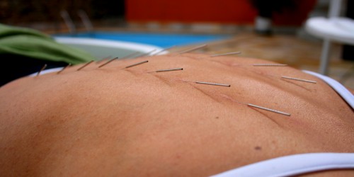 How Can Acupuncture Help When Trying To Conceive?