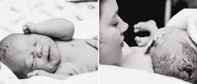 Induction of labor