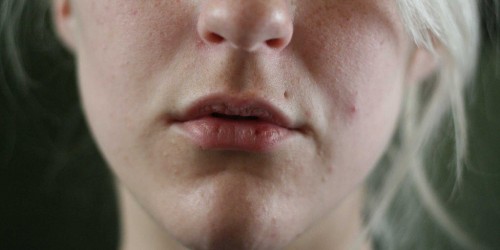 How to Choose a Lip Balm