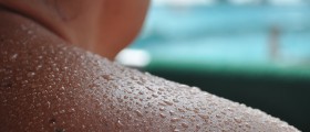 That Stinks! What Can You Do About Excessive Sweating?