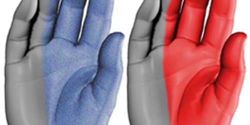 Carpal Tunnel Syndrome-Prevention