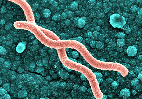 Helicobacter pylori фото