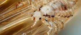 Lice Epidemic Makes Nitpicking A New American Obsession