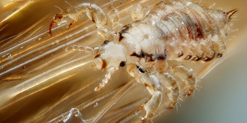 Lice Epidemic Makes Nitpicking A New American Obsession