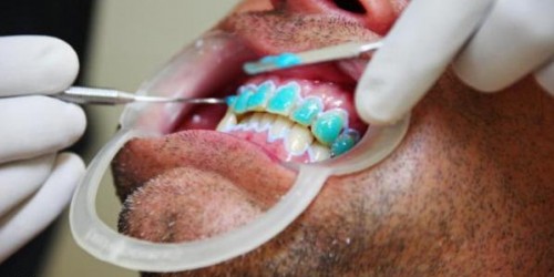 Medical Tourism In India