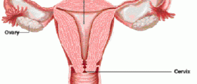 Premature ovarian failure