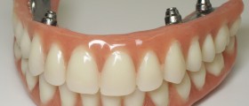 Clinical Skills Essential For The Young Indian Dentist To Survive
