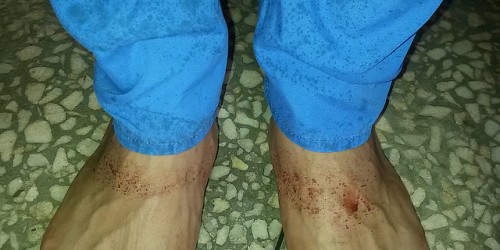 Why Doctors Sometimes Miss An Ectopic Pregnancy, And What To Do About It