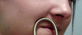 Permanent Facial Hair Removal