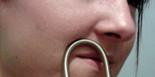 Permanent Facial Hair Removal