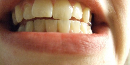 Root Canal Treatment In Children