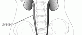 Living with failed kidneys