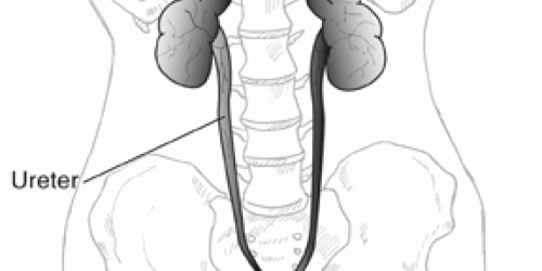 Living with failed kidneys