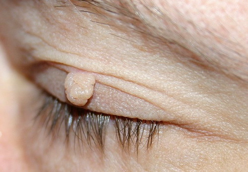 Slideshow picture