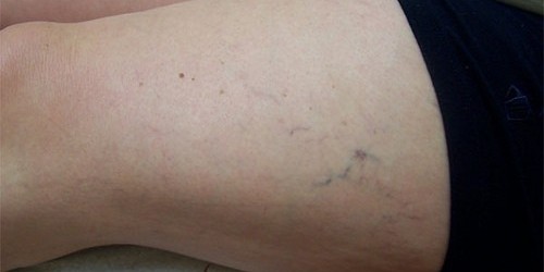 10 Of Your Most Embarrassing Beauty Questions Answered