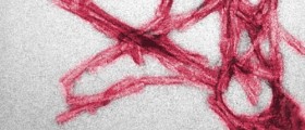 Prions Similar To The Proteins That Cause Mad-Cow Disease May Be Essential In Brain Development