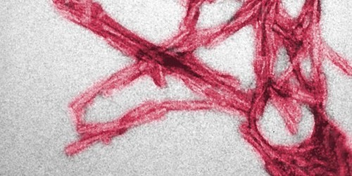 Prions Similar To The Proteins That Cause Mad-Cow Disease May Be Essential In Brain Development