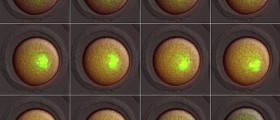 Three-Parent IVF: What, Why, And Why Not