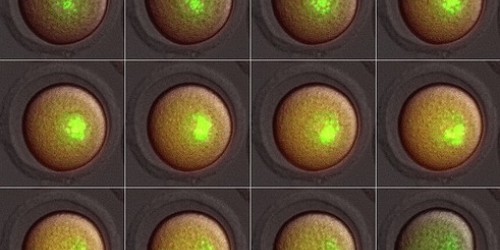 Three-Parent IVF: What, Why, And Why Not