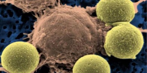Could A Single Drug Treat Every Kind Of Cancer?