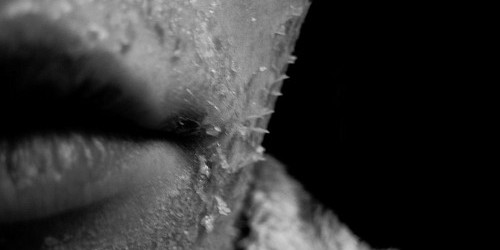 What Causes Dry Mouth, And What To Do About It