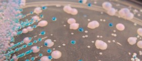 Help For Recurring Yeast Infections