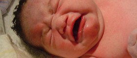 CDC Warns Against Declining Vitamin K Shot At Birth