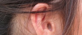 Stapedectomy for Otosclerosis