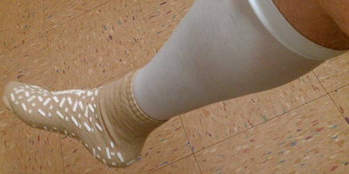 Deep Vein Thrombosis - Give Your Legs The Care They Deserve