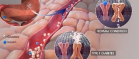 Diabetic coma symptoms