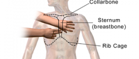 Bruised sternum review
