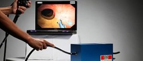 Information on colonoscopy complications