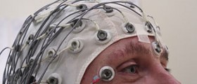 Prevention of seizures