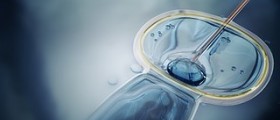 Male fertility and ICSI risks