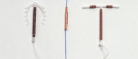 Mirena IUD