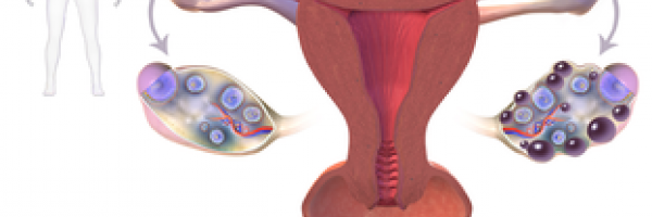 What PCOS patients need to know about weight loss and pregnancy