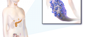 Tips on how to get pregnant with PCOS